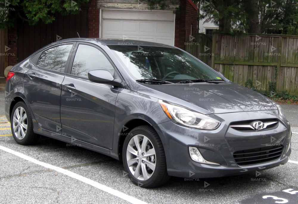 Ремонт вариатора Hyundai Accent в Сургуте